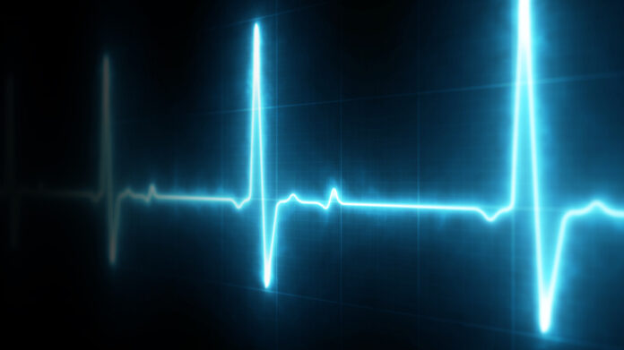 Six Abnormal Heart Rhythms to Be Aware of